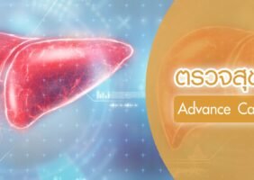 แพ็คเกจตรวจสุขภาพตับ Advance Cancer & Liver